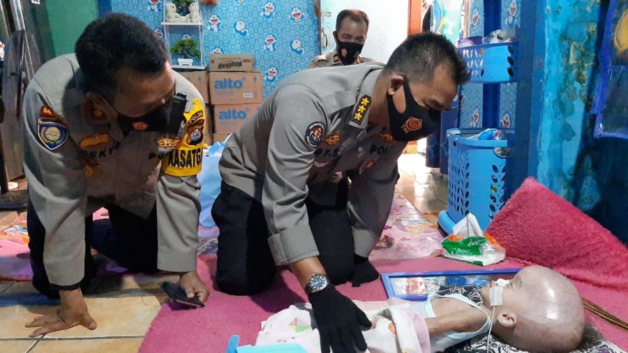Polda Banten Peduli, Bantu Balita Penderita Hydrocephalus di Serang
