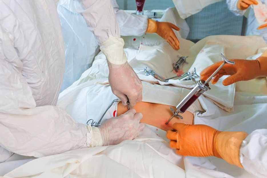 Transplantasi Sumsum Tulang Tak Lagi Mampu Memproduksi Sel Darah yang Sehat